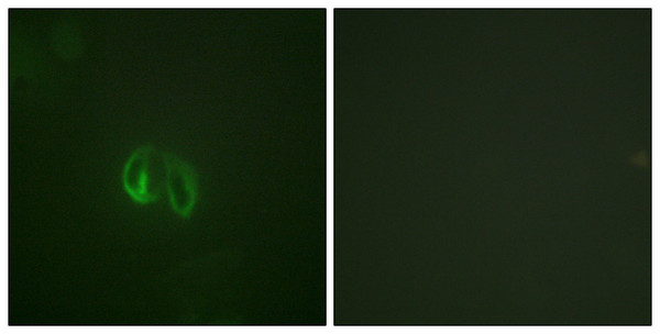 Immunofluorescence analysis of HepG2 cells, using IL-10R alpha Antibody. The picture on the right is blocked with the synthesized peptide.