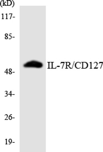 Western blot analysis of the lysates from Jurkat cells using IL-7R/CD127 antibody. Western blot analysis of the lysates from Jurkat cells using IL-7R/CD127 antibody.