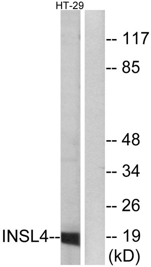 Western blot analysis of lysates from HT-29 cells, using INSL4 Antibody. The lane on the right is blocked with the synthesized peptide.