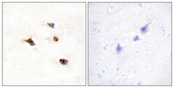 Immunohistochemistry analysis of paraffin-embedded human brain tissue, using IP6K3 Antibody. The picture on the right is blocked with the synthesized peptide. Immunohistochemistry analysis of paraffin-embedded human brain tissue, using IP6K3 Antibody. The picture on the right is blocked with the synthesized peptide.