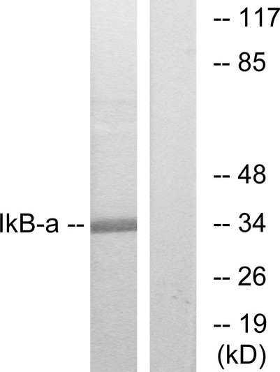 Western blot analysis of lysates from MCF7 cells, treated with TNF-Alpha, using IkappaB-alpha Antibody. The lane on the right is blocked with the synthesized peptide.