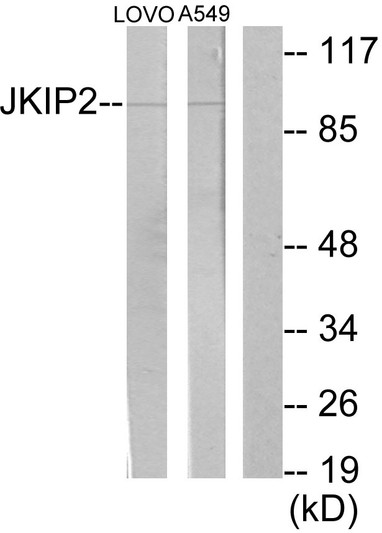 Western blot analysis of lysates from LOVO and A549 cells, using JAKMIP2 Antibody. The lane on the right is blocked with the synthesized peptide. Western blot analysis of lysates from LOVO and A549 cells, using JAKMIP2 Antibody. The lane on the right is blocked with the synthesized peptide.