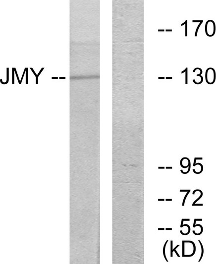 Western blot analysis of lysates from COLO cells, using JMY Antibody. The lane on the right is blocked with the synthesized peptide.