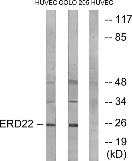 Western blot analysis of lysates from HUVEC and COLO cells, using ERD22 Antibody. The lane on the right is blocked with the synthesized peptide.