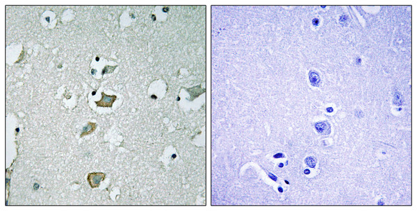 Immunohistochemistry analysis of paraffin-embedded human brain tissue, using KCNJ2 Antibody. The picture on the right is blocked with the synthesized peptide.