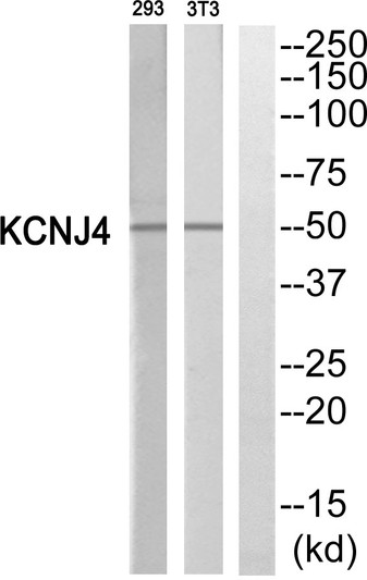 Western blot analysis of KCNJ4 Antibody. The lane on the right is blocked with the KCNJ4 peptide.