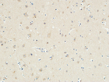 Immunohistochemical analysis of paraffin-embedded Human Brain. 1, Antibody was diluted at 1:100 (4°C overnight). 2, High-pressure and temperature EDTA, pH8.0 was used for antigen retrieval. 3, Secondary antibody was diluted at 1:200 (room temperature, 30min).