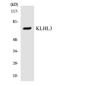 Western blot analysis of the lysates from COLO205 cells using KLHL3 antibody.