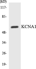 Western blot analysis of the lysates from HepG2 cells using KCNA1 antibody.