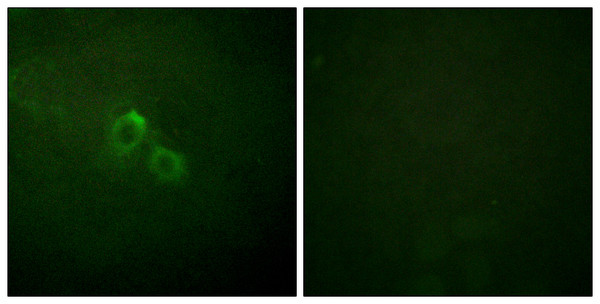 Immunofluorescence analysis of HUVEC cells, using Kv1.3/KCNA3 Antibody. The picture on the right is blocked with the synthesized peptide.