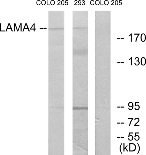 Western blot analysis of lysates from COLO and 293 cells, using LAMA4 Antibody. The lane on the right is blocked with the synthesized peptide.