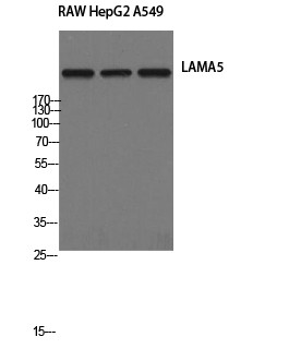 Western Blot analysis of RAW, HepG2, and A549 cells using Laminin α-5 Polyclonal Antibody STJ93892