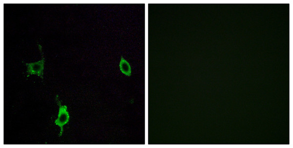 Immunofluorescence analysis of LOVO cells, using LAMC3 Antibody. The picture on the right is blocked with the synthesized peptide.