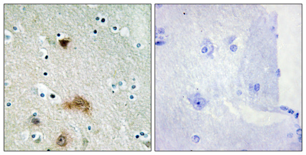 Immunohistochemistry analysis of paraffin-embedded human brain tissue, using LASS4 Antibody. The picture on the right is blocked with the synthesized peptide.