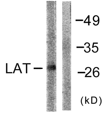 Western blot analysis of lysates from NIH/3T3 cells, using LAT Antibody. The lane on the right is blocked with the synthesized peptide.