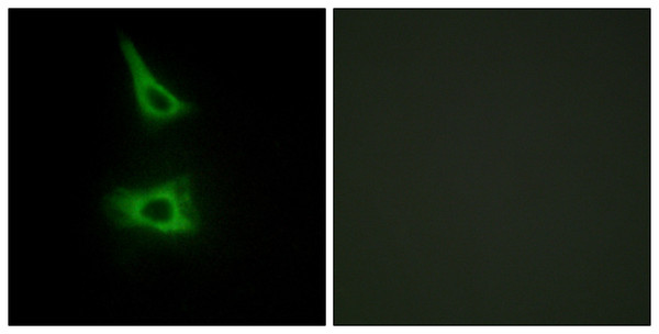 Immunofluorescence analysis of HeLa cells, using CDH17 Antibody. The picture on the right is blocked with the synthesized peptide.