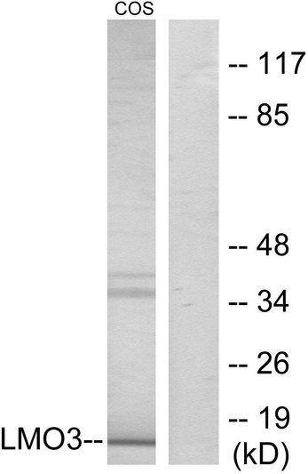 Western blot analysis of lysates from COS7 cells, using LMO3 Antibody. The lane on the right is blocked with the synthesized peptide. Western blot analysis of lysates from COS7 cells, using LMO3 Antibody. The lane on the right is blocked with the synthesized peptide.