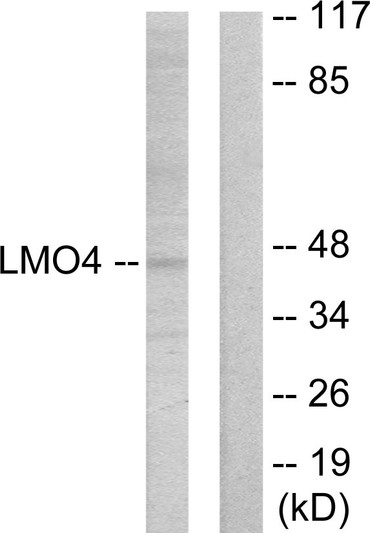 Western blot analysis of lysates from 293 cells, using LMO4 Antibody. The lane on the right is blocked with the synthesized peptide.