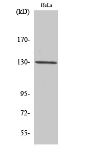Western blot analysis of HuvEc cells using LOK Polyclonal Antibody