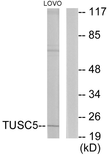 Western blot analysis of lysates from LOVO cells, using TUSC5 Antibody. The lane on the right is blocked with the synthesized peptide.