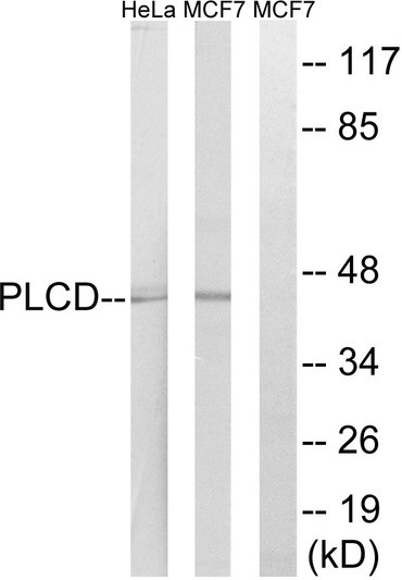 Western blot analysis of lysates from HeLa and MCF-7 cells, using AGPAT4 Antibody. The lane on the right is blocked with the synthesized peptide. Western blot analysis of lysates from HeLa and MCF-7 cells, using AGPAT4 Antibody. The lane on the right is blocked with the synthesized peptide.
