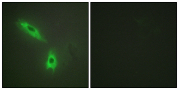 Immunofluorescence analysis of HeLa cells, using TNFC Antibody. The picture on the right is blocked with the synthesized peptide.