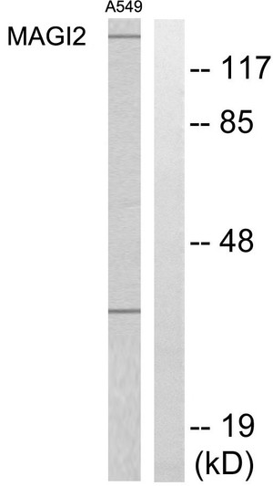 Western blot analysis of lysates from A549 cells, using MAGI2 Antibody. The lane on the right is blocked with the synthesized peptide.