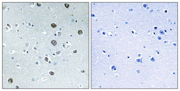Immunohistochemistry analysis of paraffin-embedded human brain tissue, using MARCH2 Antibody. The picture on the right is blocked with the synthesized peptide.