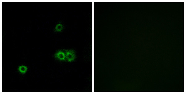 Immunofluorescence analysis of A549 cells, using MARCH5 Antibody. The picture on the right is blocked with the synthesized peptide.