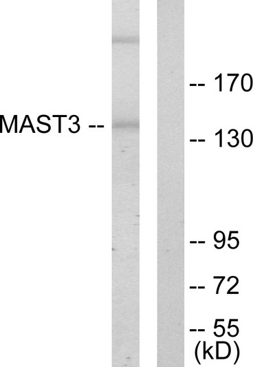 Western blot analysis of lysates from Jurkat cells, using MAST3 Antibody. The lane on the right is blocked with the synthesized peptide.