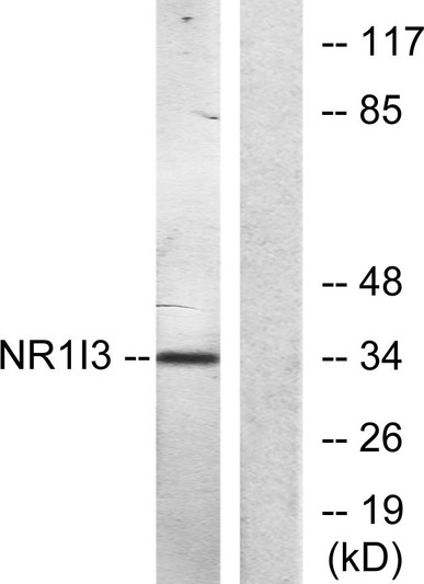 Western blot analysis of lysates from Jurkat cells, treated with 20% serum for 15', using NR1I3 Antibody. The lane on STJ94035