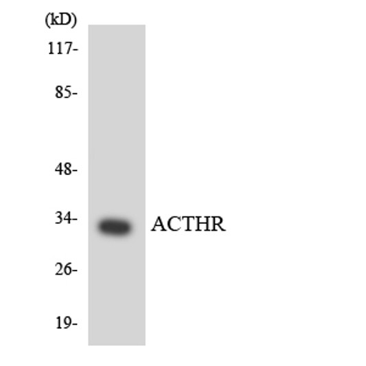 Western blot analysis of the lysates from COLO205 cells using ACTHR antibody. Western blot analysis of the lysates from COLO205 cells using ACTHR antibody.
