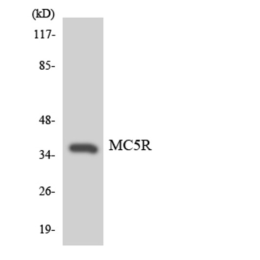 Western blot analysis of the lysates from HeLa cells using MC5R antibody.