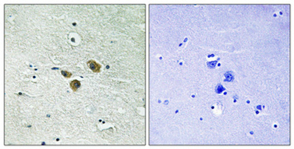 Immunohistochemical analysis of paraffin-embedded Human brain. Antibody was diluted at 1:100 (4°C overnight). High-pressure and temperature Tris-EDTA, pH8.0 was used for antigen retrieval. Negetive contrl (right) obtaned from antibody was pre-absorbed by immunogen peptide. Immunohistochemical analysis of paraffin-embedded Human brain. Antibody was diluted at 1:100 (4°C overnight). High-pressure and temperature Tris-EDTA, pH8.0 was used for antigen retrieval. Negetive contrl (right) obtaned from antibody was pre-absorbed by immunogen peptide.