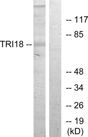 Western blot analysis of lysates from 293 cells, using TRI18 Antibody. The lane on the right is blocked with the synthesized peptide.