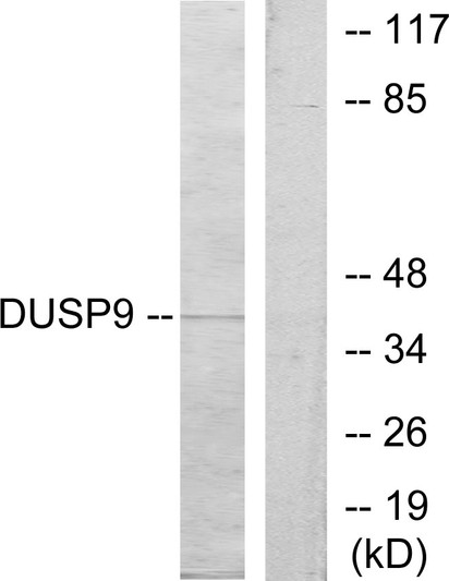Western blot analysis of lysates from HeLa cells, using DUSP9 Antibody. The lane on the right is blocked with the synthesized peptide.