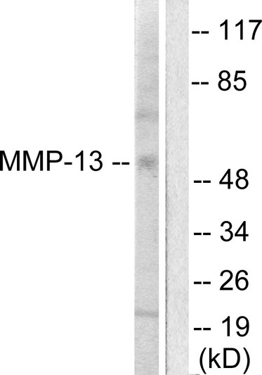 Western blot analysis of lysates from LOVO cells, using MMP-13 Antibody. The lane on the right is blocked with the synthesized peptide.