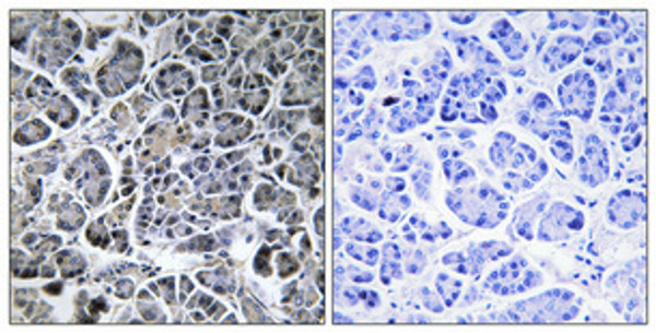 Immunohistochemical analysis of paraffin-embedded Human pancreas. Antibody was diluted at 1:100 (4°C overnight). High-pressure and temperature Tris-EDTA, pH8.0 was used for antigen retrieval. Negetive contrl (right) obtaned from antibody was pre-absorbed by immunogen peptide.