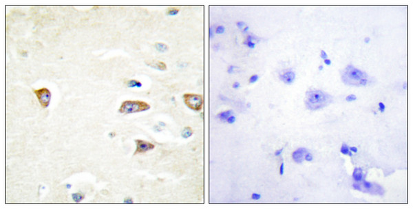 Immunohistochemistry analysis of paraffin-embedded human brain tissue, using MRCKB Antibody. The picture on the right is blocked with the synthesized peptide.