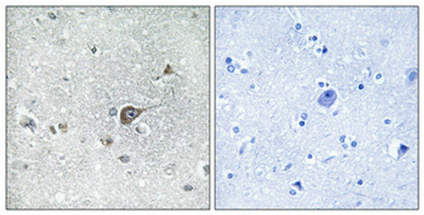 Immunohistochemical analysis of paraffin-embedded Human brain. Antibody was diluted at 1:100 (4°C overnight). High-pressure and temperature Tris-EDTA, pH8.0 was used for antigen retrieval. Negetive contrl (right) obtaned from antibody was pre-absorbed by immunogen peptide. Immunohistochemical analysis of paraffin-embedded Human brain. Antibody was diluted at 1:100 (4°C overnight). High-pressure and temperature Tris-EDTA, pH8.0 was used for antigen retrieval. Negetive contrl (right) obtaned from antibody was pre-absorbed by immunogen peptide.