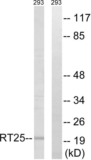 Western blot analysis of lysates from 293 cells, using MRPS25 Antibody. The lane on the right is blocked with the synthesized peptide.