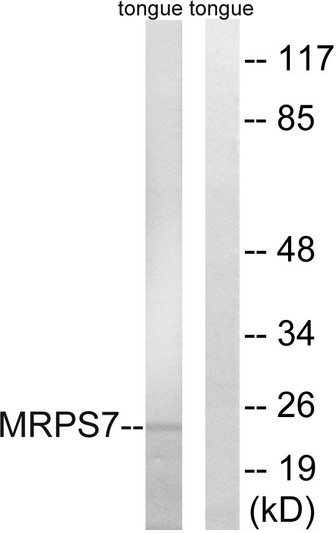 Western blot analysis of lysates from rat tongue cells, using MRPS7 Antibody. The lane on the right is blocked with the synthesized peptide.