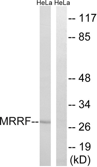 Western blot analysis of lysates from HeLa cells, using MRRF Antibody. The lane on the right is blocked with the synthesized peptide.