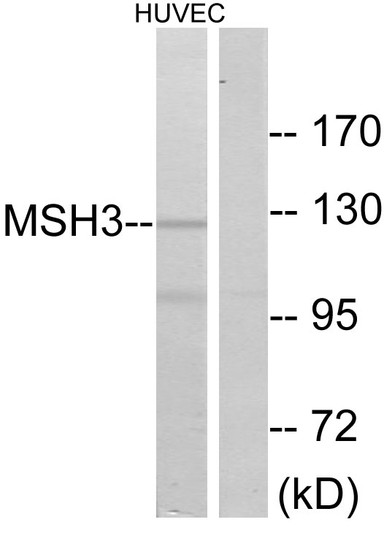 Western blot analysis of lysates from HUVEC cells, using MSH3 Antibody. The lane on the right is blocked with the synthesized peptide.