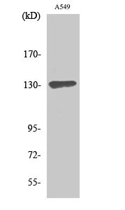 Western blot analysis of various cells using Sin3B polyclonal antibody STJ94263