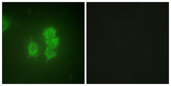 Immunofluorescence analysis of HUVEC cells, using MSK1 Antibody. The picture on the right is blocked with the synthesized peptide.