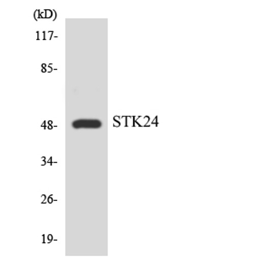 Western blot analysis of the lysates from COLO205 cells using STK24 antibody.