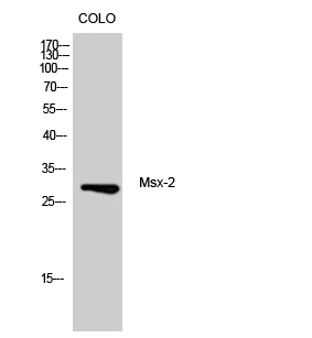 Western blot analysis of CoLo cells using Msx-2 polyclonal antibody STJ94270