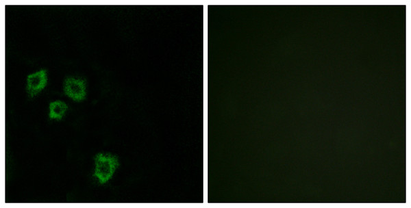 Immunofluorescence analysis of HepG2 cells, using MUC16 Antibody. The picture on the right is blocked with the synthesized peptide.