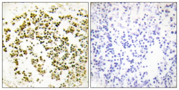 Immunohistochemistry analysis of paraffin-embedded human lymph node tissue, using Musculin Antibody. The picture on the right is blocked with the synthesized peptide.